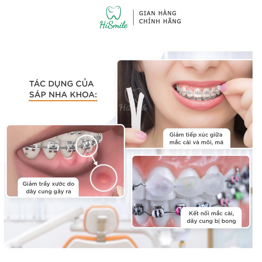 Ảnh SÁP NHA KHOA Dynaflex dành cho người chỉnh nha 2