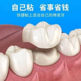 Keo Sứ Dán Cố Định Răng Kim Loại Chuyên Dụng