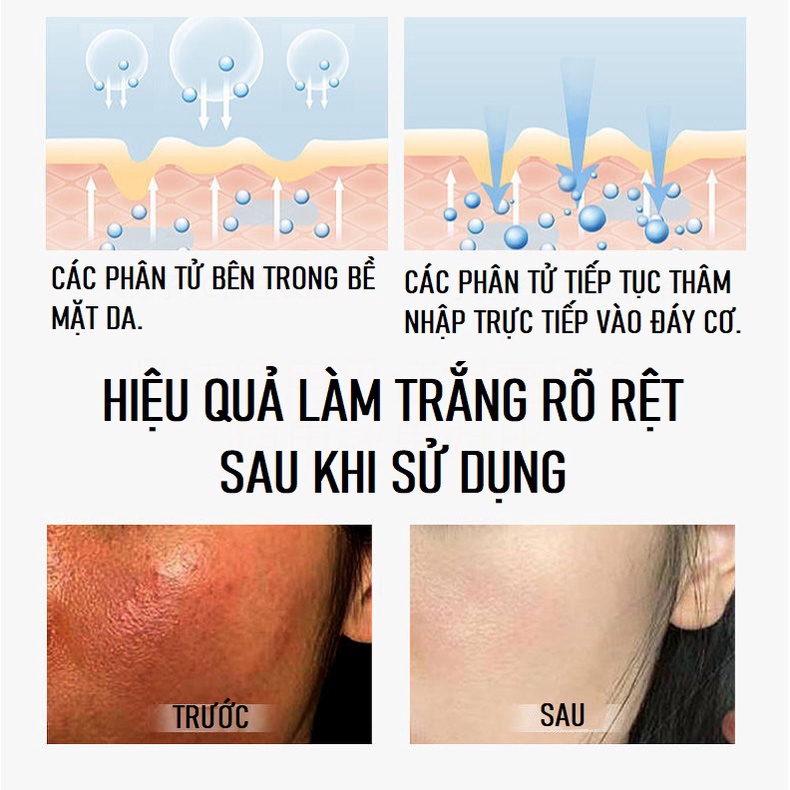 [Chính Hãng]Serum Vitamin C Disaar 30m Serum Trắng Sáng Da,Mờ Thâm Nám Dưỡng Ẩm, Cải Thiện Làn Da Xỉn Màu, Chống Lão Hoá