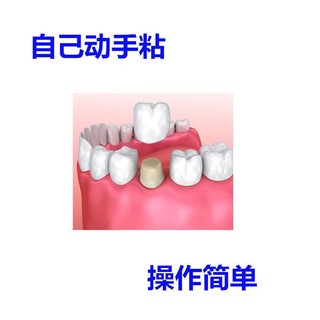 Keo Sứ Dán Cố Định Răng Kim Loại Chuyên Dụng