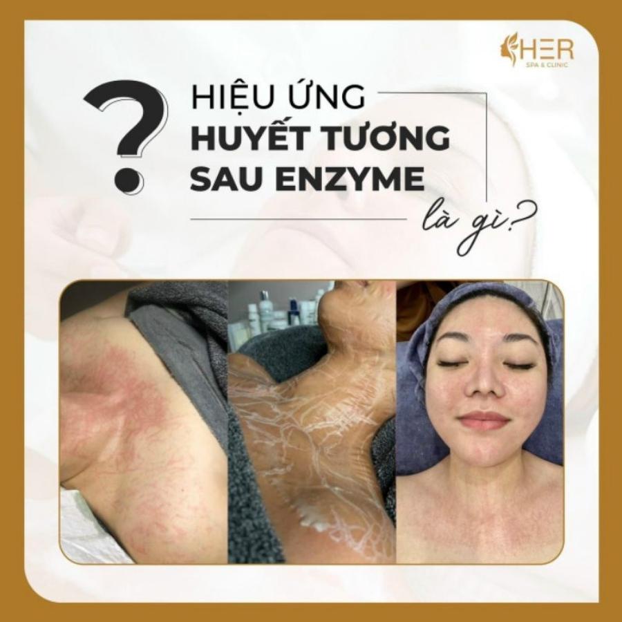 Ứng dụng Enzyme Therapy trong làm đẹp