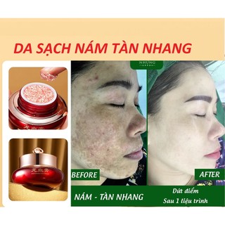 Kem nám và chống tàn nhang thảo dược SÂM NẤM LINH CHI da trắng sáng và dưỡng ẩm - Hiệu quả chỉ 28 ngày sử dụng