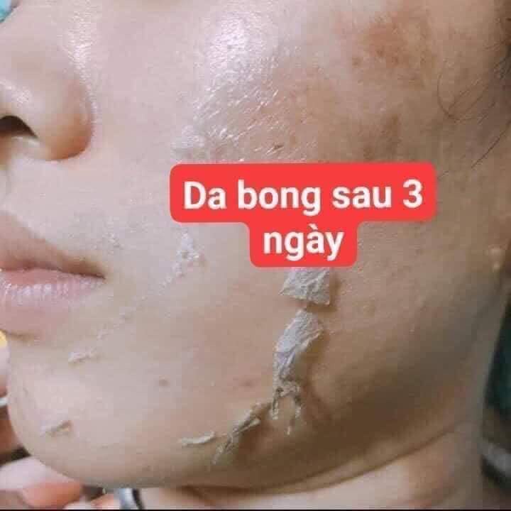 trẻ hóa tái tạo da Siêu Vi Kim Thảo Dược (Chính Hãng)