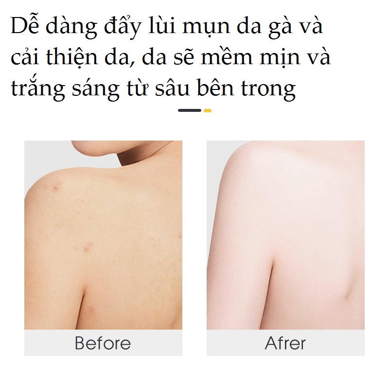 [Chai 400ml] Sữa Tắm Muối Biển Dưỡng Trắng, Xóa Mụn, Hết Viêm Da Cơ Địa Milky Moisturizing Bath Salts Giúp Tẩy Tế Bào Ch