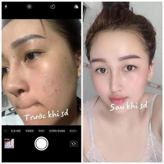 Combo Kem MEIDUZI Face Ngày và Đêm Nhật MEIDUZI Giúp Dưỡng Trắng Mờ Thâm Nám Sáng Mịn Da