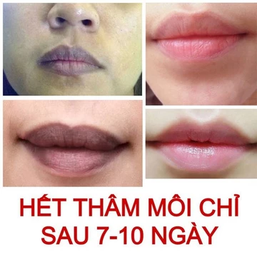 Dưỡng môi collagen Thiên Di khử thâm môi dưỡng hồng môi giúp môi mềm mịn an toàn 100%