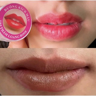-DƯỠNG KÍCH MÀU THÂM LOANG ROSE