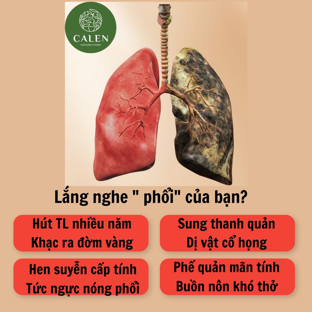 [Bổ phế phổi] Trà Thảo Mộc Giảm Ho Calen Nature's Farm Giảm Đau Rát Họng, Khàn Tiếng, Bổ Phổi bịch 30 gói lọc