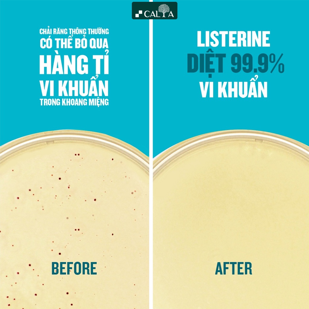 Ảnh Bộ 2 Chai Nước Súc Miệng Listerine Diệt Khuẩn, Thơm Mát - Listerine Coolmint Mouthwash 750ml x 2 4