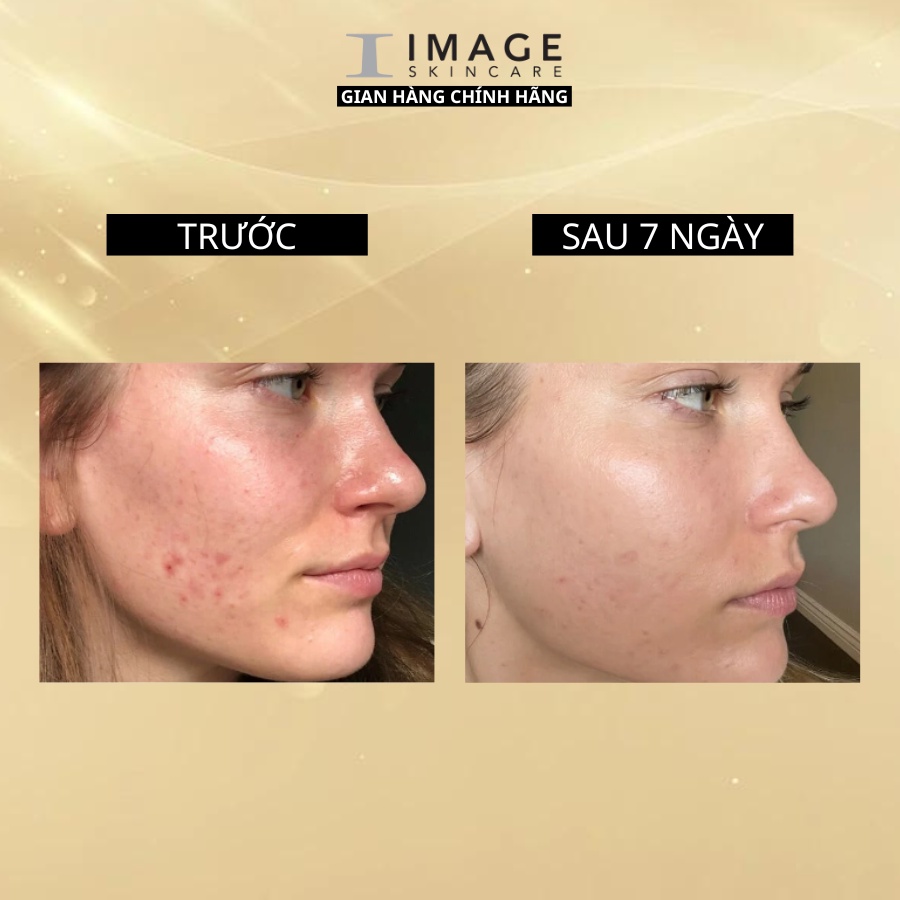 Ảnh Viên uống ngăn ngừa mụn Image Skincare HUSH & HUSH Skincapsule Clear+ 60 viên 3
