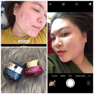 Combo Kem MEIDUZI Face Ngày và Đêm Nhật MEIDUZI Giúp Dưỡng Trắng Mờ Thâm Nám Sáng Mịn Da
