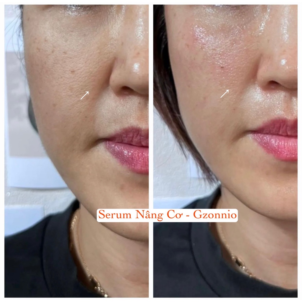 Firmming Bright Serum ( Nâng Cơ Gzonnio )