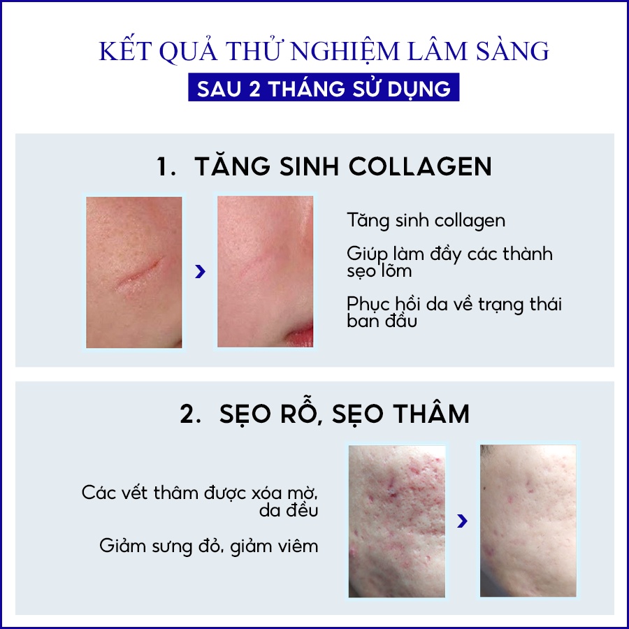 Ảnh Kem làm mờ sẹo thâm, lấp đầy sẹo rỗ, lõm Scar Esthetique REJUVASKIN 30ml 3