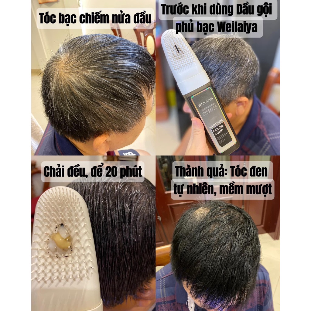 Dầu gội phủ bạc dưỡng tóc Weilaiya 3 màu - PHUONGANHOUSE