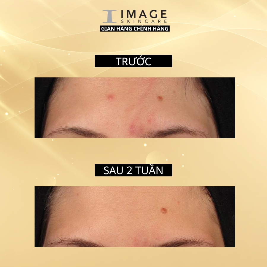 Ảnh Kem kiểm soát mụn và điều tiết nhờn Image Clear Cell Clarifying Repair Creme 4