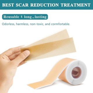 Baby Auricle Valgus Correction Patch for Newborns 4cm Correct Deformed Ears