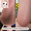Kem mềm da nail Xina chính hãng - Kem làm mềm da cải thiện tình trạng thô ráp, sần sùi mùi ngẫu nhiên