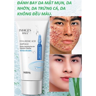 SỮA RỬA MẶT NAM ( đã ra bao bì mới) GIỚI ĐÁNH BAY MỤN LÀM DA TRẮNG SÁNG KIỀM DẦU 60g