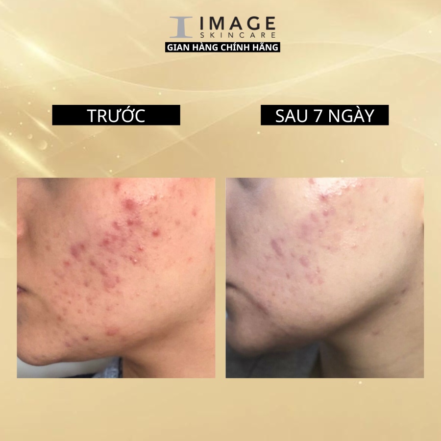 Ảnh Viên uống ngăn ngừa mụn Image Skincare HUSH & HUSH Skincapsule Clear+ 60 viên 4