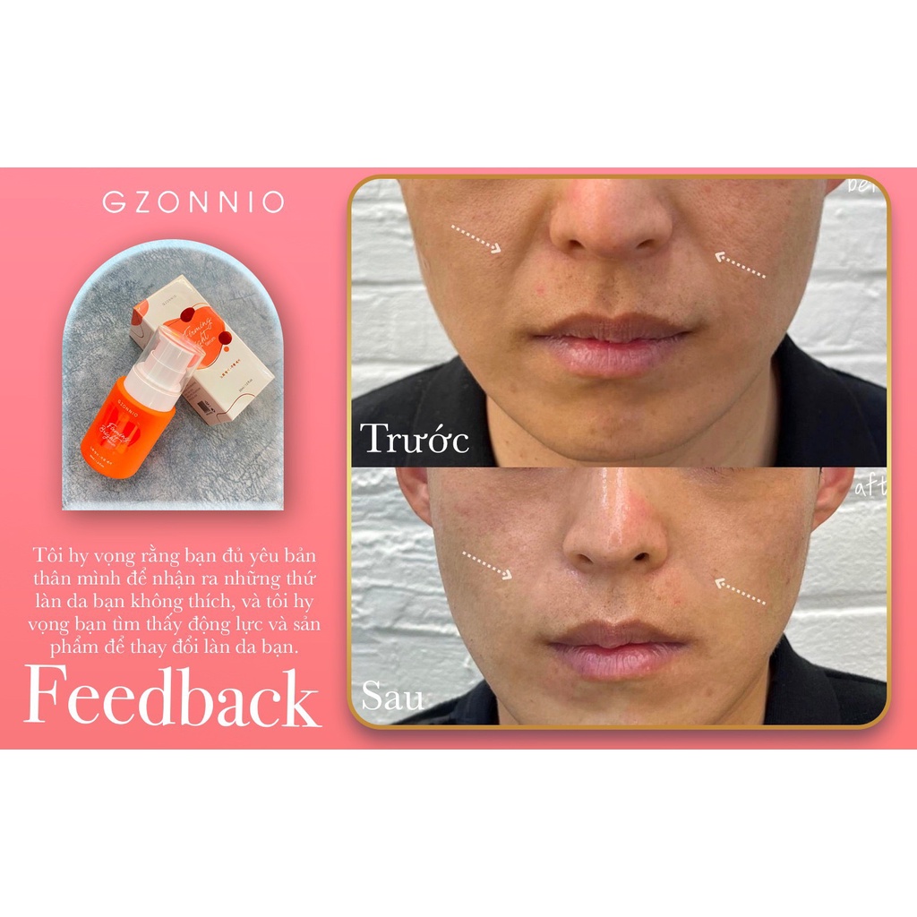Firmming Bright Serum ( Nâng Cơ Gzonnio )