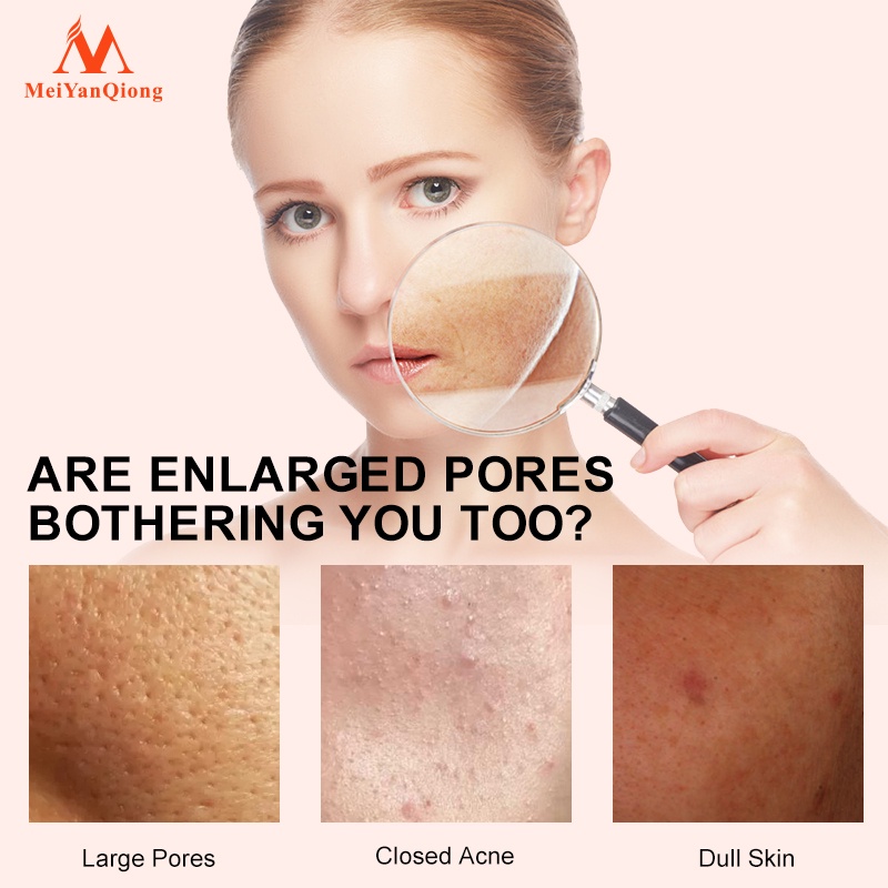 Ảnh MeiYanQiong Tinh chất Pore Se Giúp Thu Nhỏ Lỗ Chân Lông Và Làm Sáng Da 10ml 2