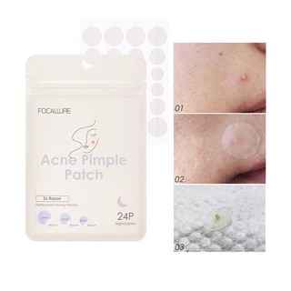 [Y168] Miếng dán mụn FOCALLURE - không thấm nước, tiện dụng 2g