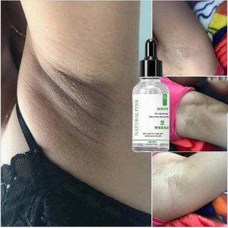 Tinh Chất Serum giảm thâm nách, mông ,bẹn, đầu gối, thâm chân tay, 30ml