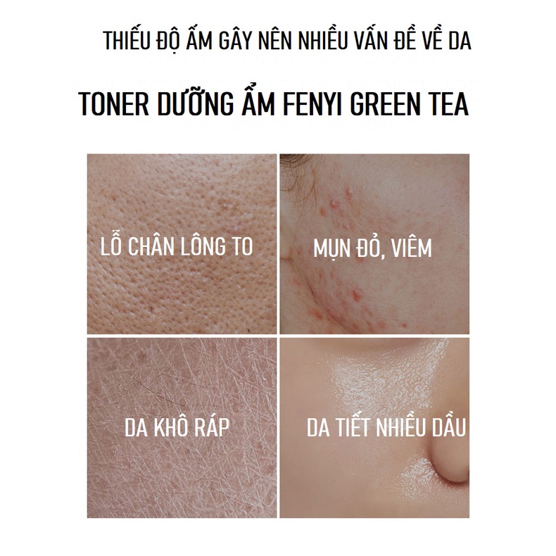 Toner Trà Xanh FENYI Green Tea 100ml Dưỡng Trắng, Cấp Ẩm, Loại Bỏ Dầu Thừa Và Se Khít Lỗ Chân Lông, Giúp Da Trắng Sáng