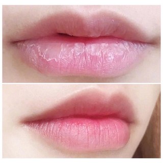 Son Dưỡng Môi Collagen Thiên Di Khử Thâm Môi, Dưỡng Hồng Môi Và Ti Giúp Môi Mềm Mịn An Toàn CHo Mẹ Mầu Và Sau Sinh