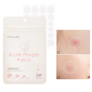 [Y168] Miếng dán mụn FOCALLURE - không thấm nước, tiện dụng 2g