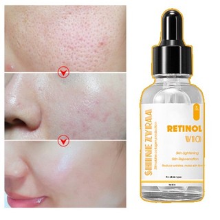 Serum Retinol V10  Shine Zyza Chống Lão Hóa Trắng da, Mờ thâm Làm Giảm Nếp Nhăn Hiệu Quả 30ml
