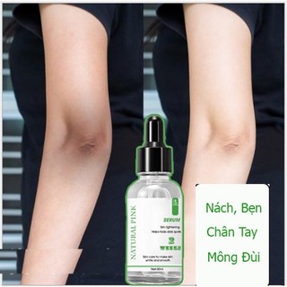 Serum Thâm Mụn Thâm Chân Tay, Đầu Gối Nách Bẹn Sáng Da Ngừa Thâm Hiệu Quả