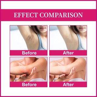 Kem Làm Trắng Vùng Da Dưới Cánh Tay Chứa Vitamin E Và Ceramide 2.11 fl.oz
