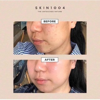 Nước hoa hồng Skin1004 Madagascar Centella Toning Toner 210ML giảm mụn, phục hồi da - Bebeau
