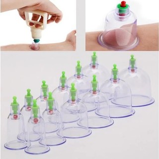 Bộ Giác Hơi Tại Nhà 12 Món Đầy Đủ Phụ Kiện