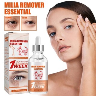 South Moon Milia Remover Essential Serum Nourish 30ml