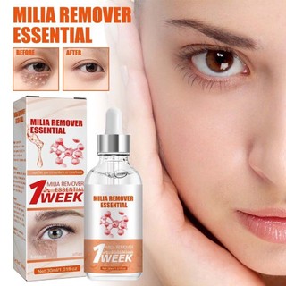 South Moon Milia Remover Essential Serum Nourish 30ml