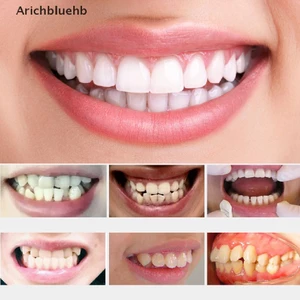 < Arichbluehb > Đai Nẹp Chỉnh Hình Răng Chăm Sóc Răng Miệng