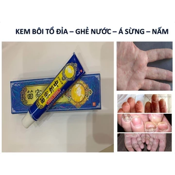 Combo 2 tuýp Kem Bôi Đông Y Thảo Dược Viêm Da Cơ Địa Xanh Dương 15g