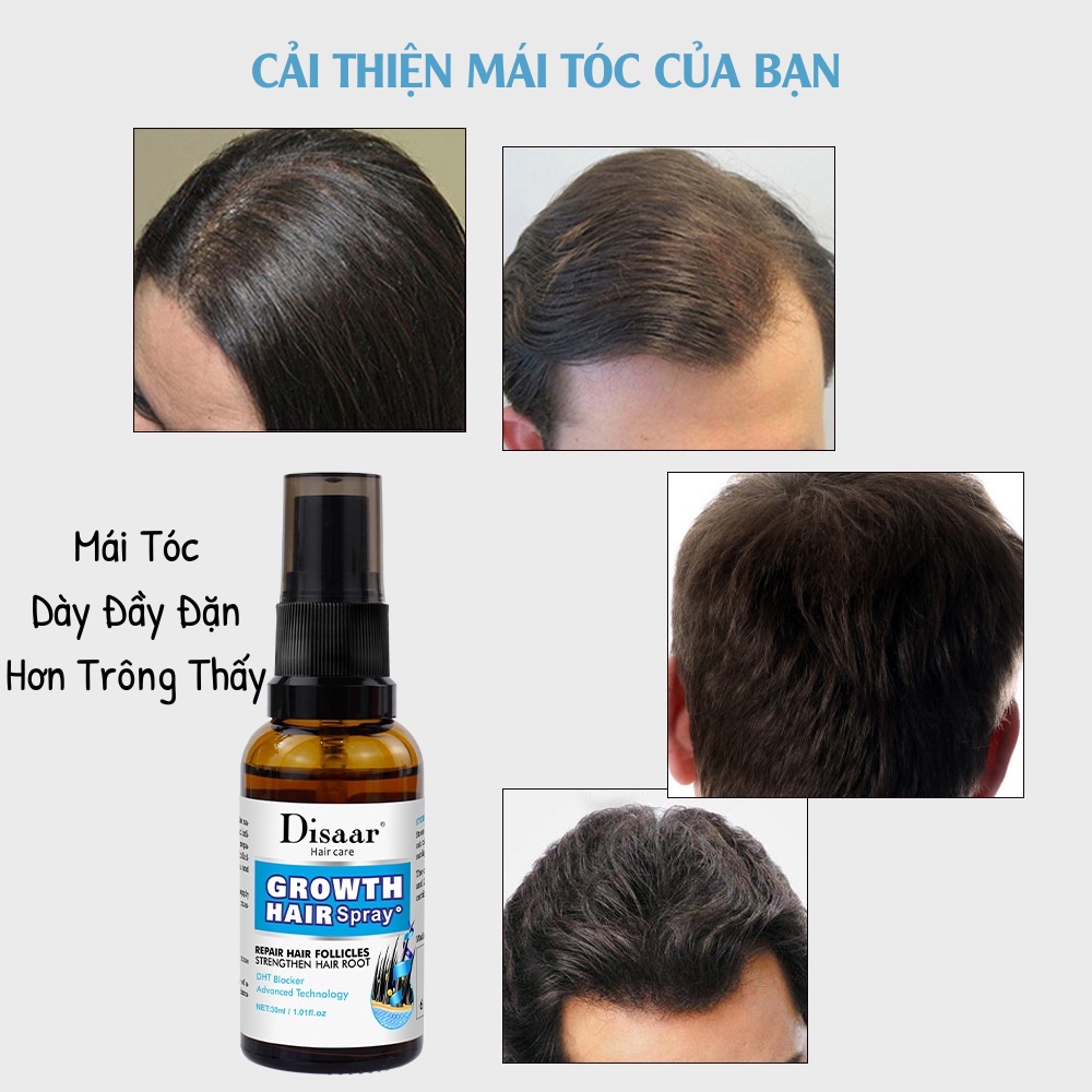 Tinh Chất Thảo Dược Kích Thích Mọc Tóc và Phục Hồi Hư Tổn Từ Sâu Bên Trong Disaar Growth Hair Spray
