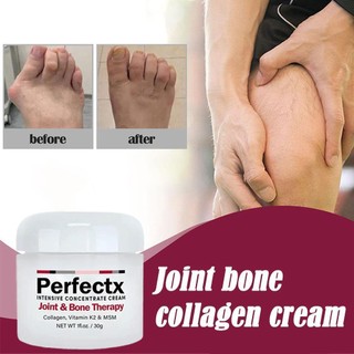 [Giá Thấp] Perfectx Joint Cream Kem Xoa Bóp Và điều Trị Xương Khớp Tập Trung Vào Việc Phục Hồi Các Khớp Và Cơ Giảm đau Lưng/cổ,/cánh Tay/chân Feelnature