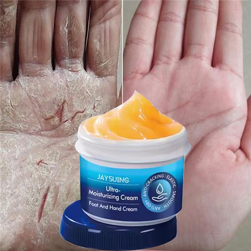 Kem Dưỡng Da Tay Chân Chống Nứt Nẻ Dưỡng Ẩm Làm Trắng Loại Bỏ Da Chết Hiệu Quả