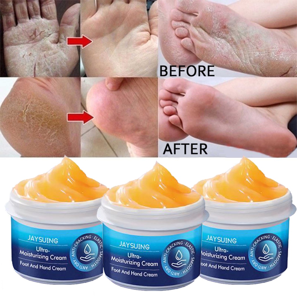 Kem Dưỡng Da Tay Chân Chống Nứt Nẻ Dưỡng Ẩm Làm Trắng Loại Bỏ Da Chết Hiệu Quả