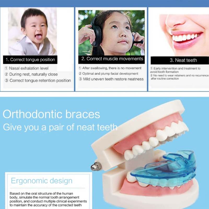 Richh teeth trainer cho trẻ em trẻ em thiết bị chỉnh nha răng căn chỉnh nha nha khoa nẹp miệng pha soft replacem