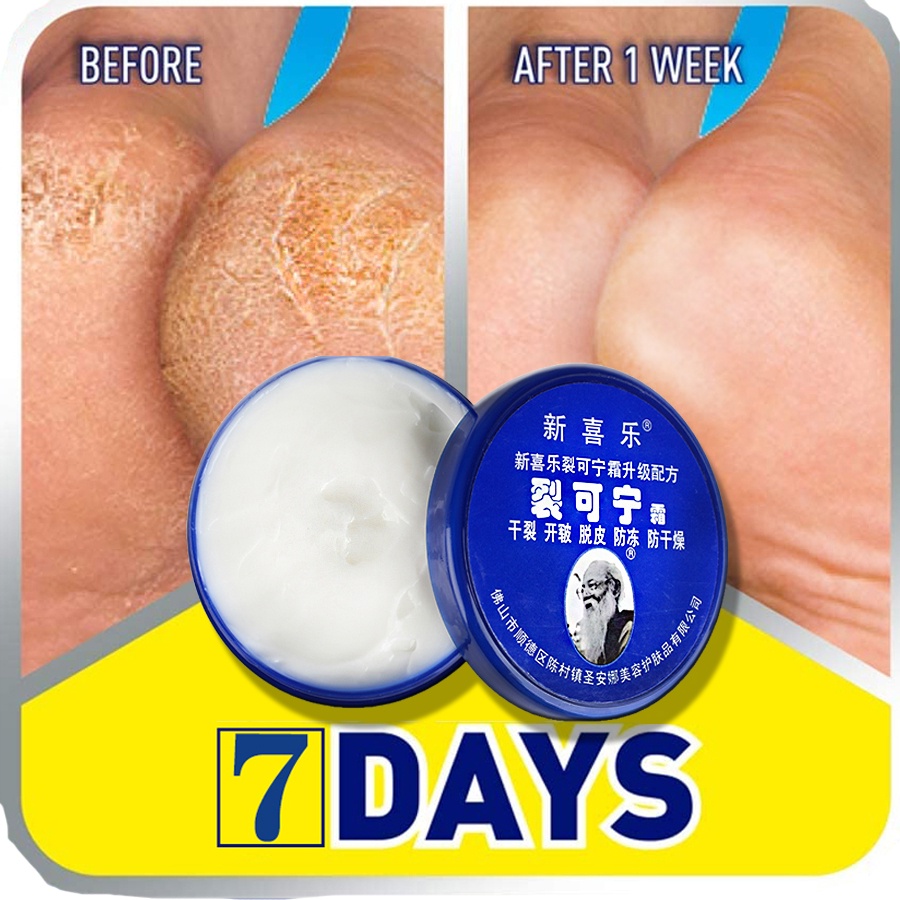 Dầu truyền thống Trung Quốc chống khô nứt nẻ Kem dưỡng da chân nứt nẻ Kem sửa chữa loại bỏ da chết để chăm sóc cơ thể bàn chân tay