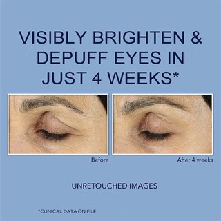 ROC Retinol Correxion Line Smoothing Eye Cream, Even Tone + Lift Eye Cream, Revive Glow Eye Balm, dark circle