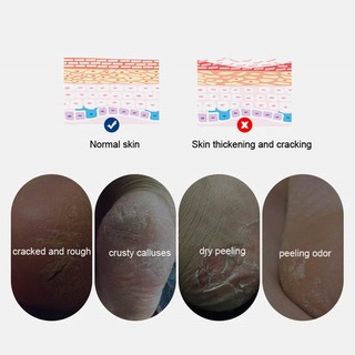 Miếng Đệm Bảo Vệ Gót Chân Giúp Giảm Đau Tiện Dụng