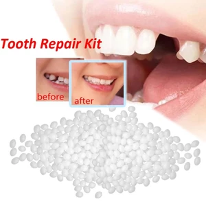 Keo Dán Nhựa Resin Giả Màu Trơn Làm Răng Giả Tạm Thời An Toàn