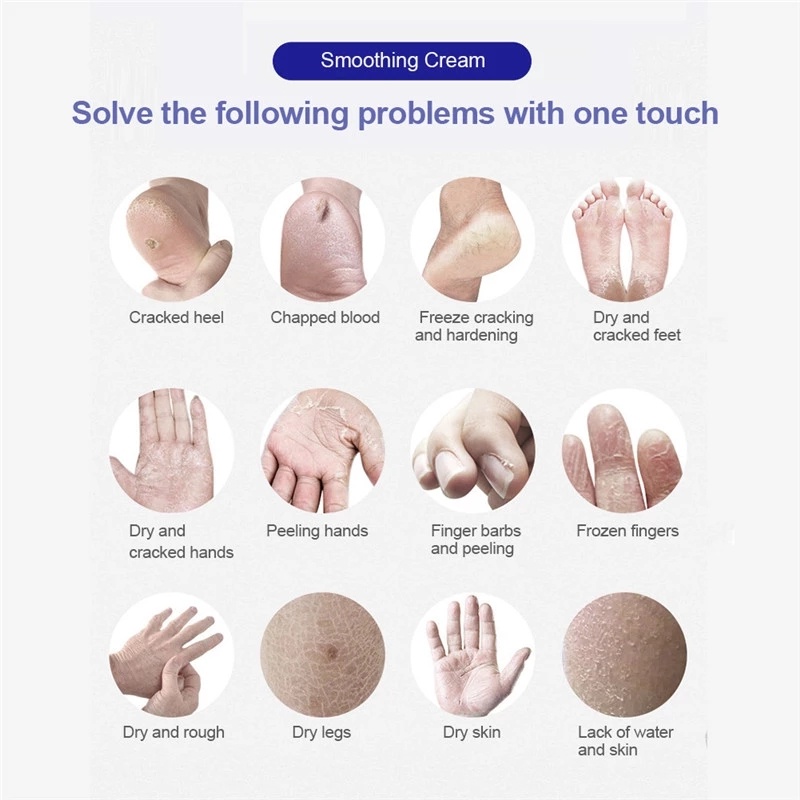 Ảnh Kem dưỡng da truyền thống Trung Quốc ANNIES chống khô nứt da chân phục hồi loại bỏ da chết chăm sóc cơ thể 4