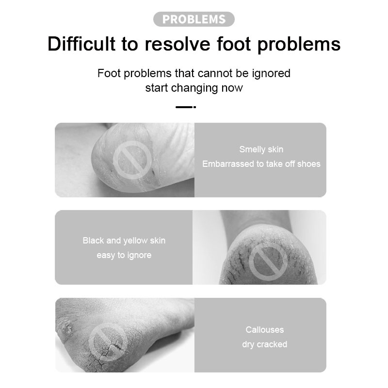 Đệm Silicone Bảo Vệ Gót Chân Khi Mang Giày Cao Gót